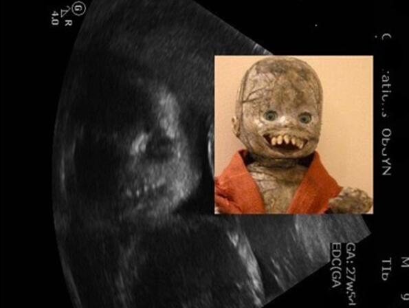 Бебета в утробата, приличащи на какво ли не