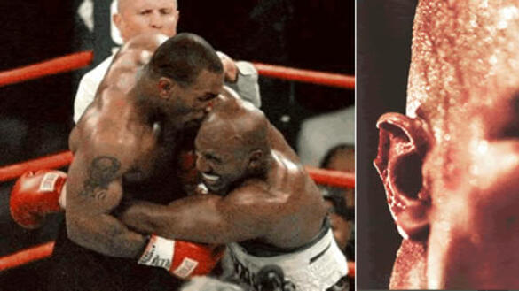 Най-бруталните контузии в историята на бокса