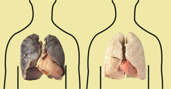 Задължително четиво за пушачи: 4 продукта, които прочистват белия дроб