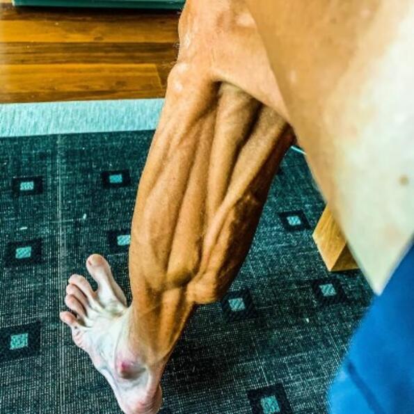 Велосипедист сподели шокираща снимка на мускулите на краката си след състезание