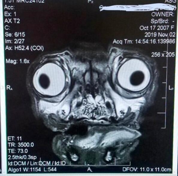 Рентгенова снимка на мопс: Истински ужас