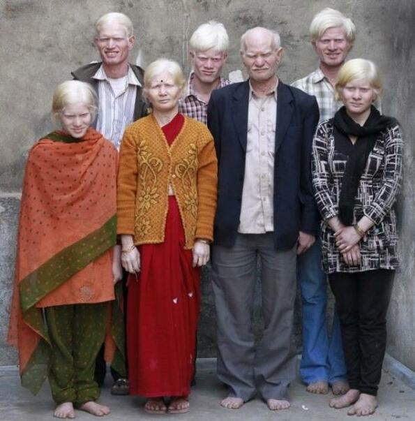 Виждал ли си индийци албиноси?