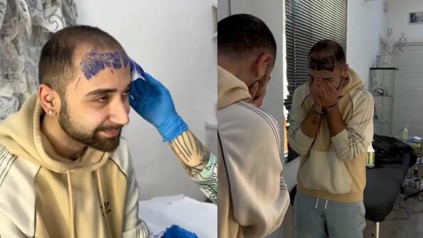 Идиот на годината: Плешив мъж си татуира бретон, погледна се в огледалото и се разплака