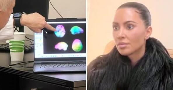 Доктор каза на Ким Кардашян, че има „ниска мозъчна активност“