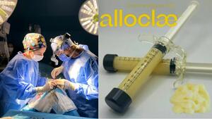 Пластичните хирурзи в САЩ вече използват мазнини от мъртви тела за козметични процедури