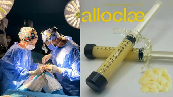 Пластичните хирурзи в САЩ вече използват мазнини от мъртви тела за козметични процедури