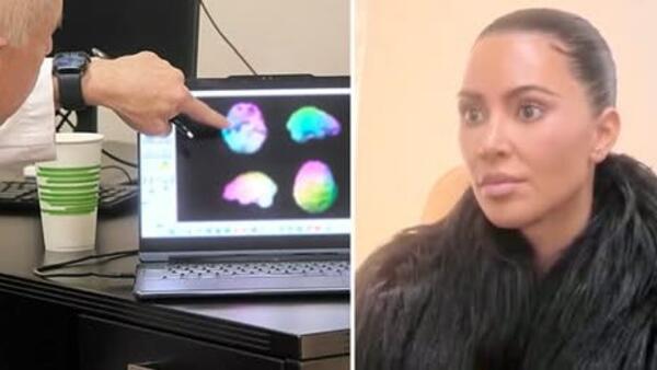 Доктор каза на Ким Кардашян, че има „ниска мозъчна активност“