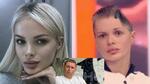 Рускиня загуби почти половината си череп след брутално нападение от партньора ѝ